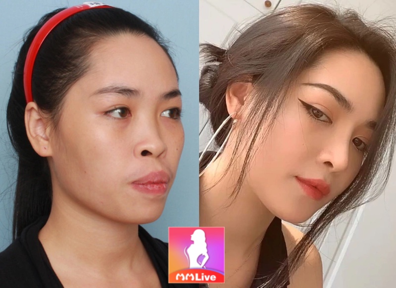 Vũ Thanh Quỳnh - Cuộc đời được “cứu rỗi” nhờ dao kéo quá thành công 1 Vũ Thanh Quỳnh